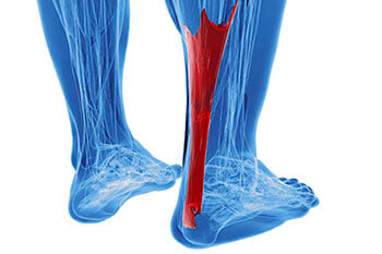 achilles tendon treatment in Chicago, IL 60614, Highland Park, IL 60035 and Chicago, IL 60640