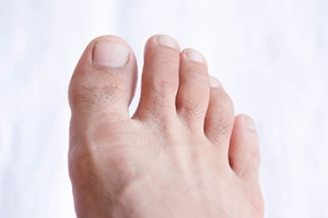 Arthritic Big Toe Surgery