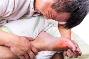 What Can Cause Painful Gout Attacks?