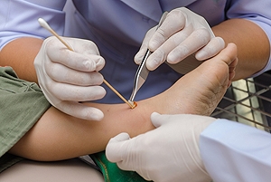 The Wagner Diabetic Foot Ulcer Classification System