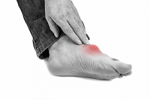 Staying Active With Gout