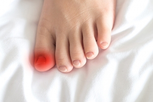 Common Causes of Toenails