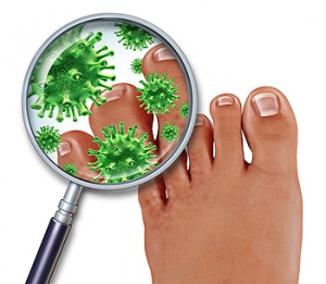 Causes of Toenail Fungus