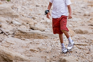 Facts About Clubfoot