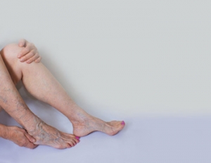 Foot Care for the Elderly