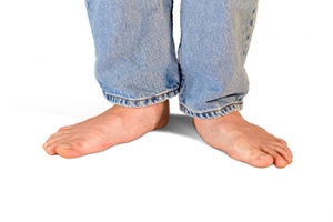 Definition and Causes of Flat Feet